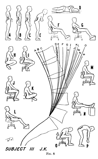 Diagram showing angles of the lumbar spine in different positions